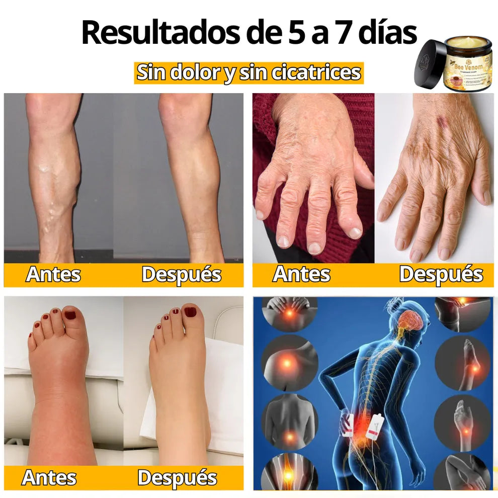 | COMPRA 1, LLEVA 2 | Bee Venom: El Poder Regenerador de la Naturaleza para una Piel Libre de Imperfecciones